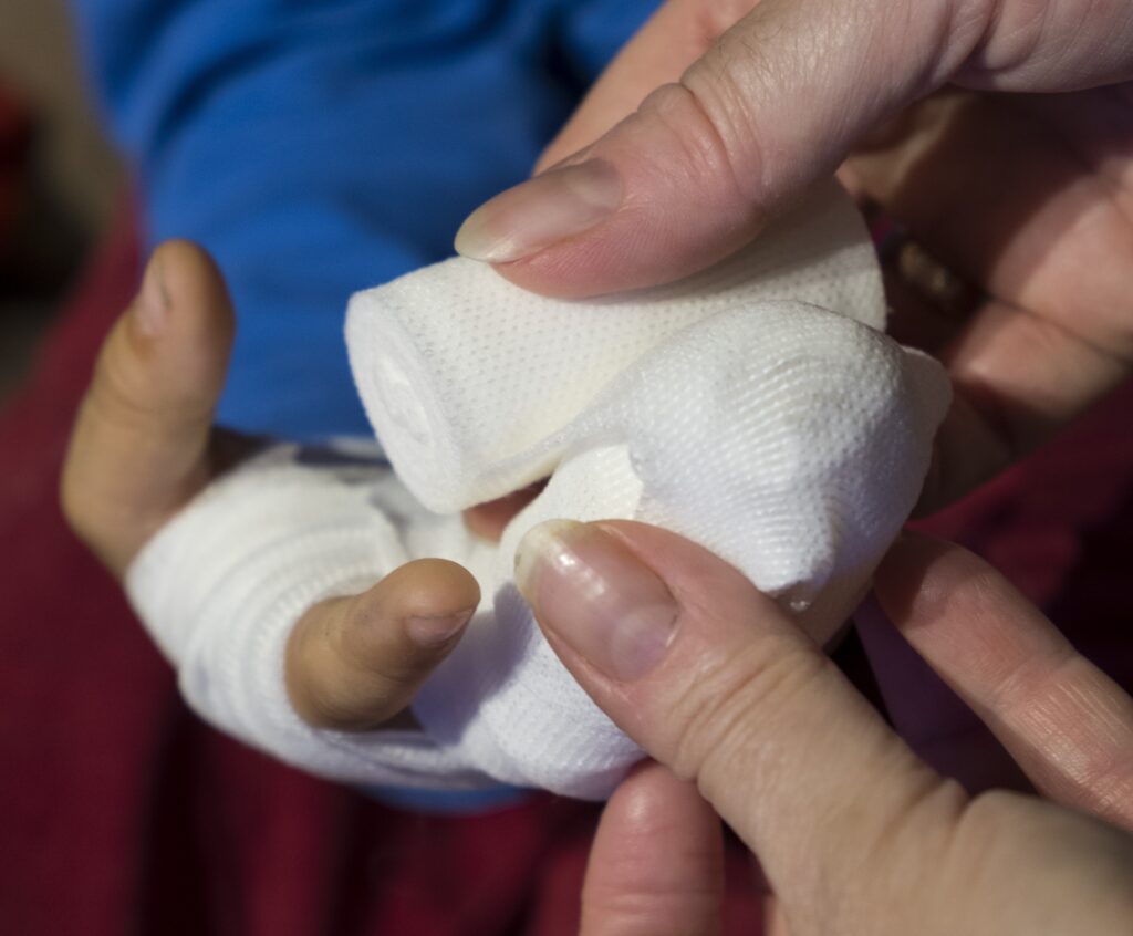 Wrapping an injured hand in a bandage